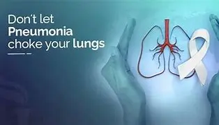 Image for Understanding Pneumonia: A Deep Dive into Causes, Symptoms, Treatment, and Prevention